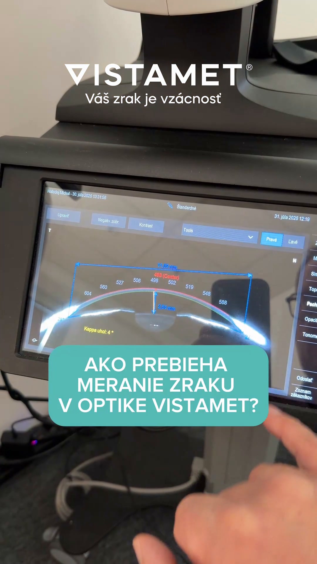 V OPTIKE VISTAMET veríme, že ostrý zrak nie je luxus, ale základ každodenného pohodlia. 👀 Pri vstupe do našej vyšetrovne vás čaká moderné prostredie a špičková technológia, vďaka ktorej presne zmapujeme potreby vašich očí. Celé meranie zraku prebieha v pokojnej atmosfére, bez zbytočného zhonu. 💻Získate nielen presné dioptrie, ale aj odborné odporúčanie, aké sklá vám prinesú najväčší komfort a úľavu od únavy očí. 👓✨

Doprajte si opäť stopercentne čistý pohľad na svet a rezervujte si svoj termín na meranie zraku ešte dnes cez správu alebo priamo na odkaze v BIO. 📲📅

📍 Optika VISTAMET, Považská Bystrica
📞 Objednávky: 042/290 16 02
🌐 Rezervácie: https://www.vistamet.sk
